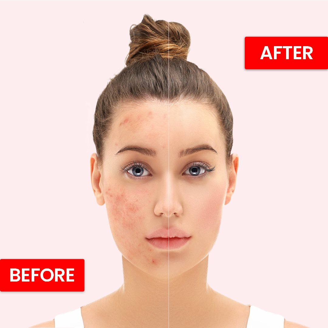 Face Fresh Beauty Cream Jar 35g - Image 2