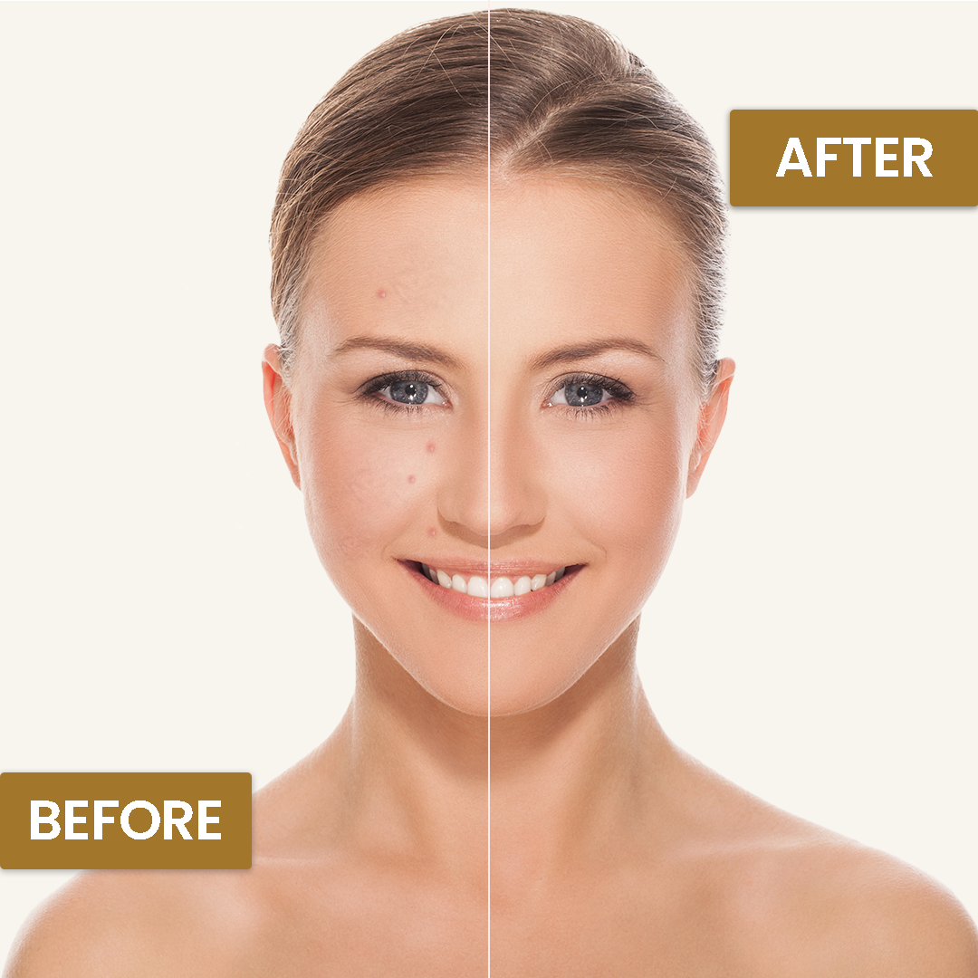 Face Fresh Gold Plus Beauty Cream Jar 230g - Image 2