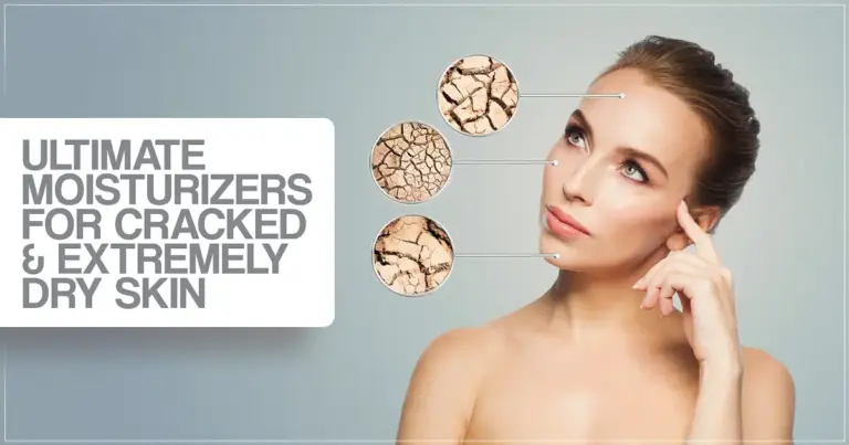 Ultimate Moisturizers for Cracked & Extremely Dry Skin