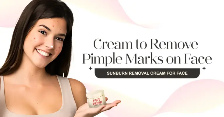 Sunburn Removal Cream for Face & Cream to Remove Pimple Marks on Face