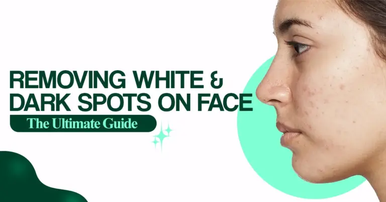 Removing White and Dark Spots on Face – The Ultimate Guide