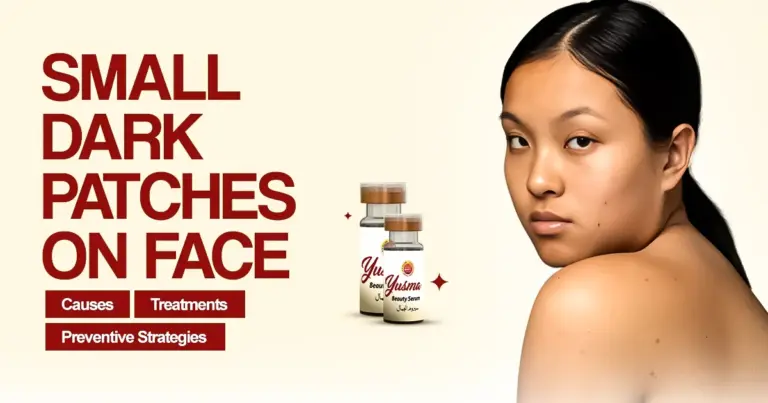 Small Dark Patches on Face: Causes, Treatments, and Preventive Strategies