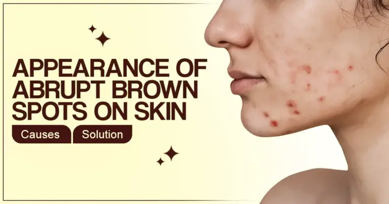 What May Cause an Appearance of Abrupt Brown Spots on Skin & Their Solutions