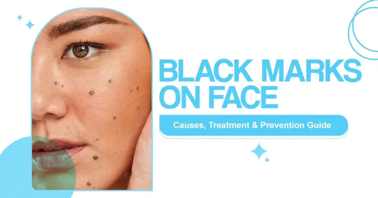 Black Marks on Face: Causes, Treatment & Prevention Guide